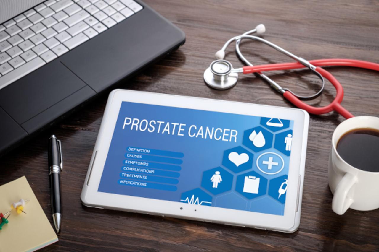 Interaktivni slučaj – rak prostate