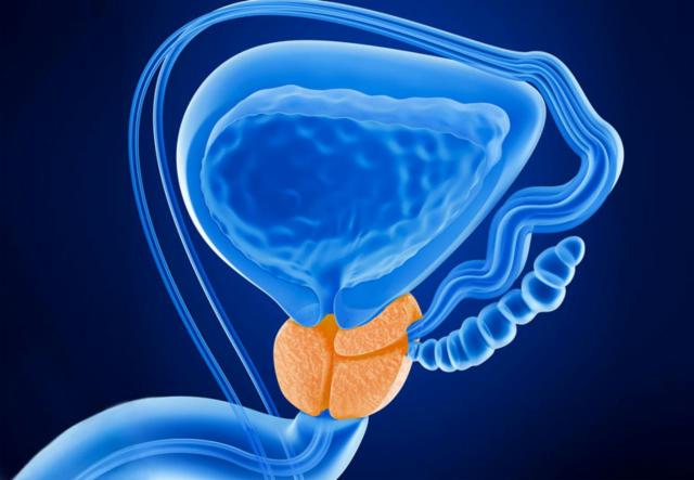Interaktivni slučaj – praćenje bolesnika s rakom prostate