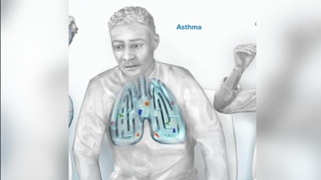 Astma - interaktivni modul